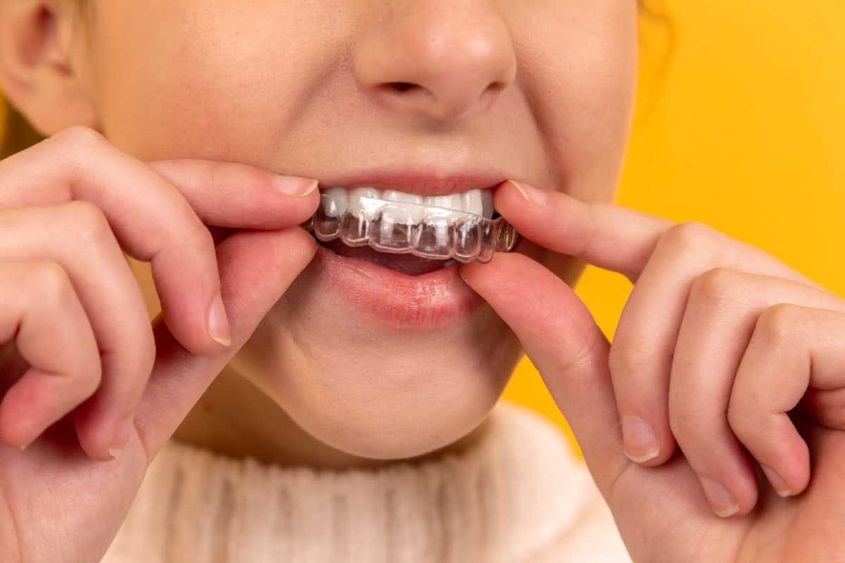 Close study of a natural smile for dental aesthetics